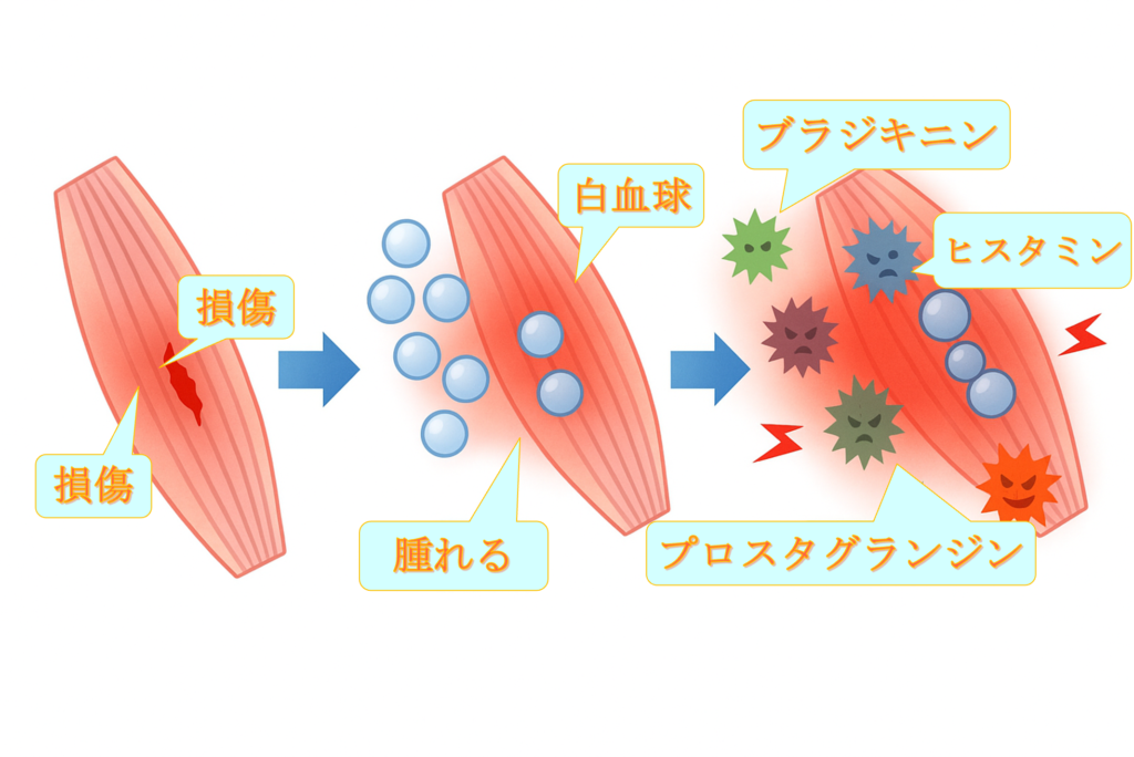 痛みの発生について、ブラジキニン、ヒスタミン、プロスタグランジンなどの八痛物質による影響